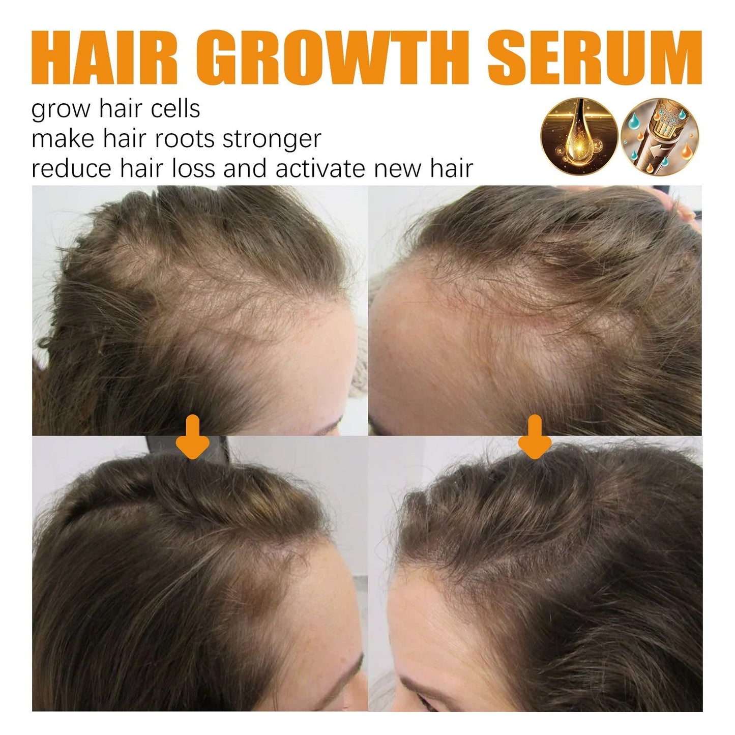 HairBoost Growth Essence